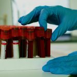 Cães detectam sinais de câncer em amostras de sangue